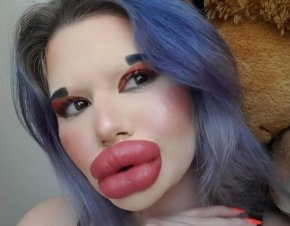 Българка за която се твърди че има най големите устни в