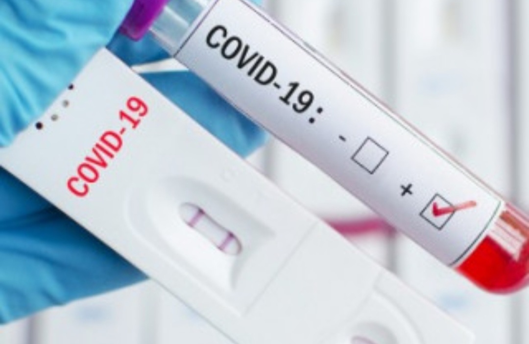 456 са новите случаи на коронавирус у нас Направените изследвания