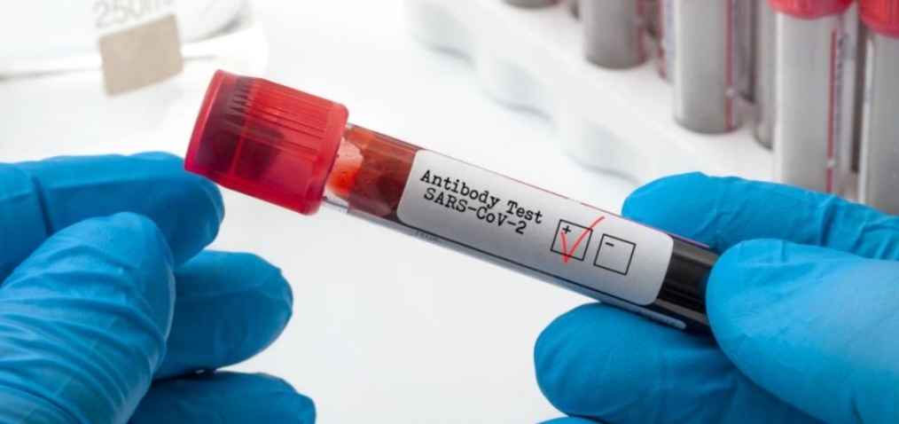 За последното денонощие у нас са регистрирани 7062 нови случая