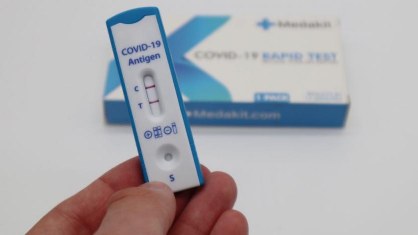 Покана за поръчка на 7 милиона 610 хиляди бързи антигенни