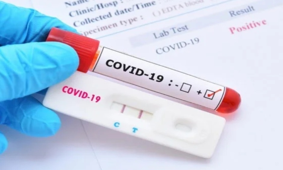 2 379 нови случая на коронавирус са били регистрирани през