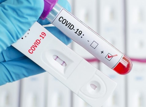 11 143 са новите случаи на COVID 19 за последното денонощие показват