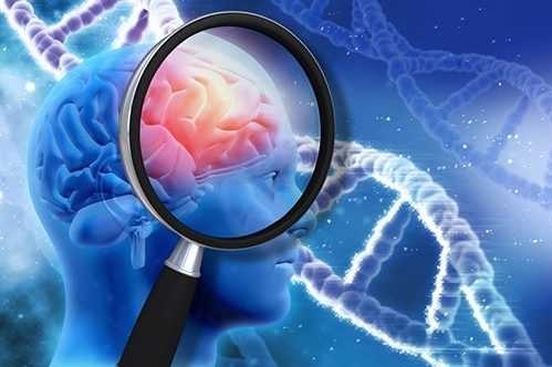 Хората които умират от тежък COVID 19 имат изменения в мозъка