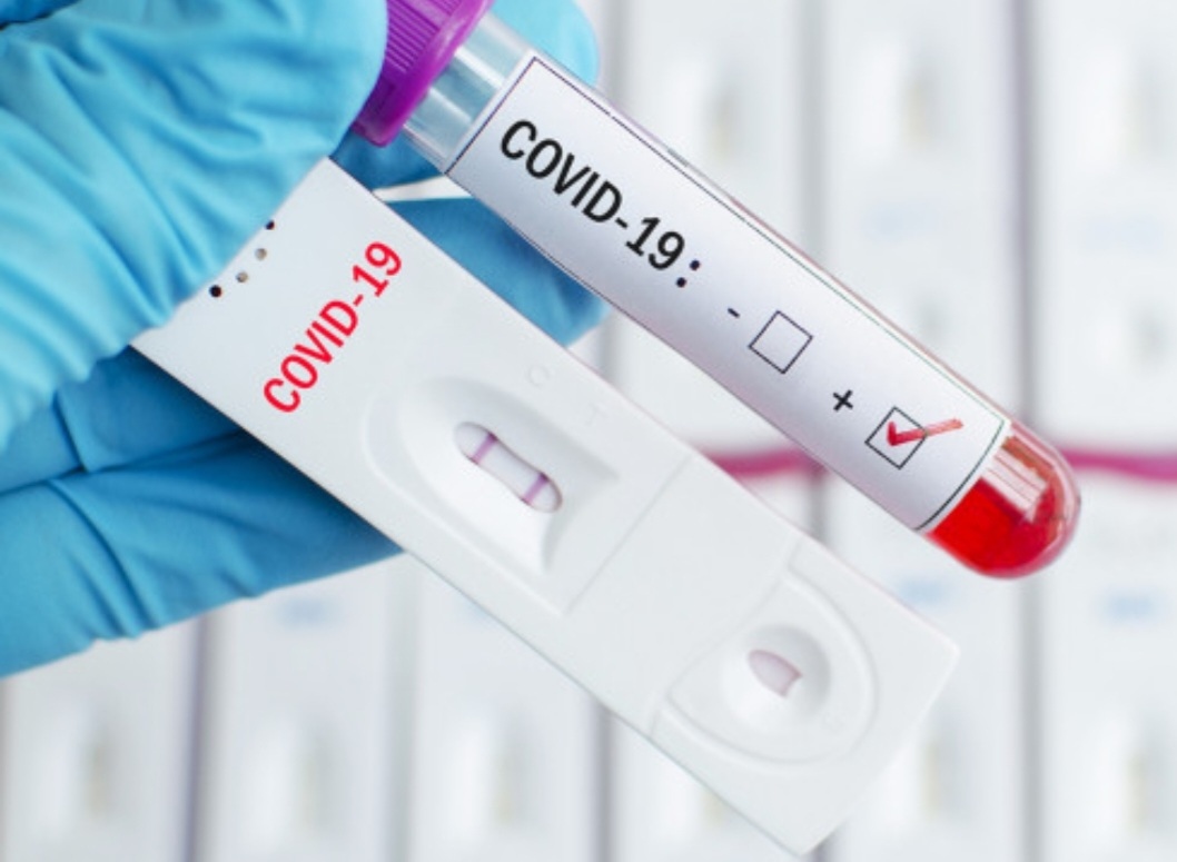 2462 са новите случаи на коронавирус показват данните в Единния