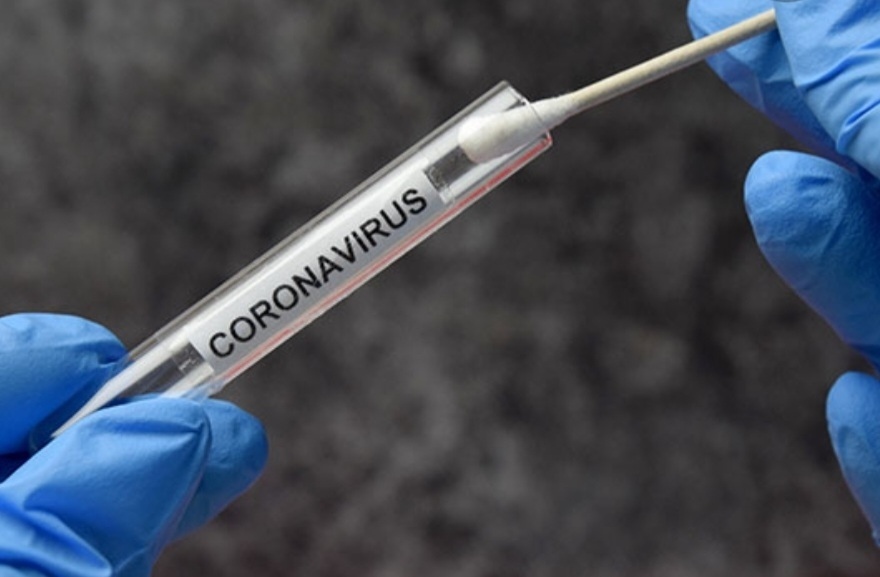 1920 са новите случаи на коронавирус