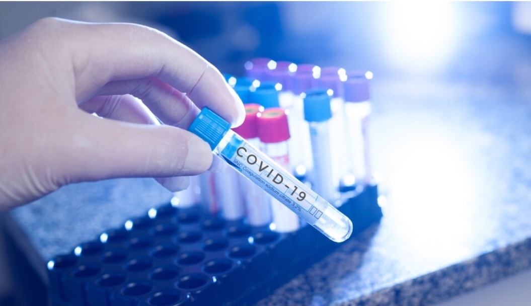 Новите случаи на коронавирус у нас за последното денонощие са