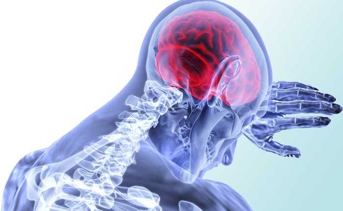 Имаме случаи на млади пациенти които получават мозъчни инсулти и