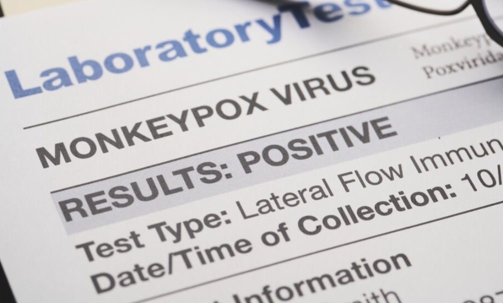 Европейските държави ще бъдат приканени да подготвят ваксинационен план за