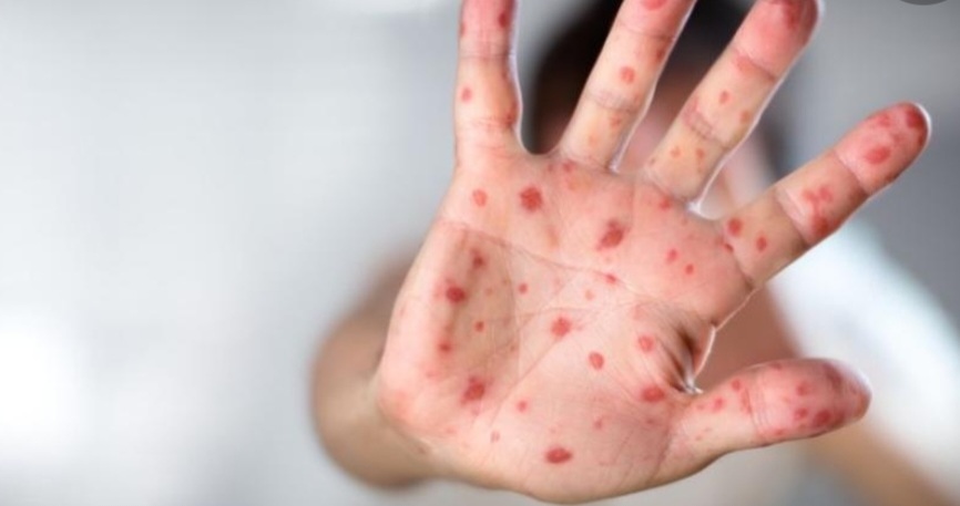 Здравните власти във Великобритания препоръчаха 21 дневна карантина за хората които