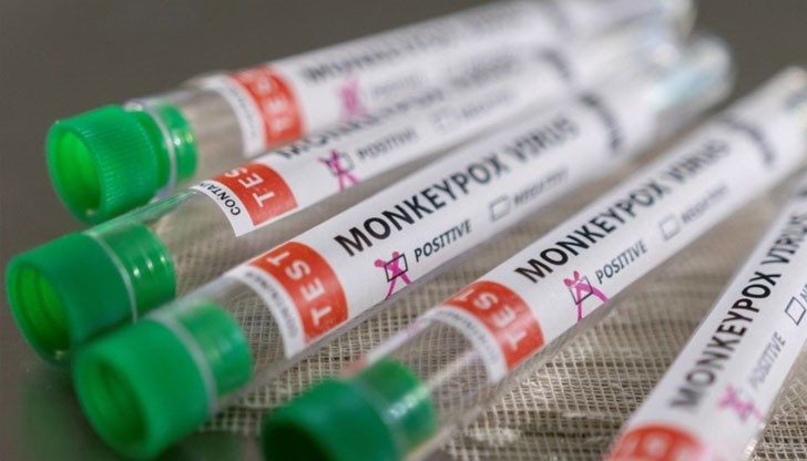 Здравните власти във Великобритания призоваха хората заразени с маймунска шарка