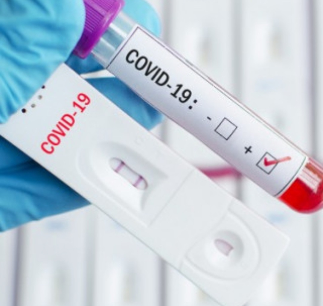 182 са новите случаи на коронавирус у нас Близо 4 5