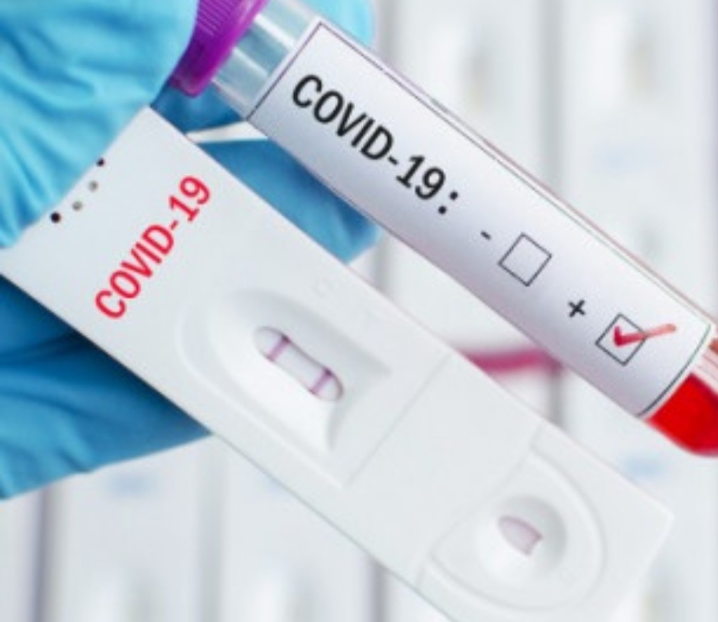 381 са новите случаи на COVID 19 у нас Това е