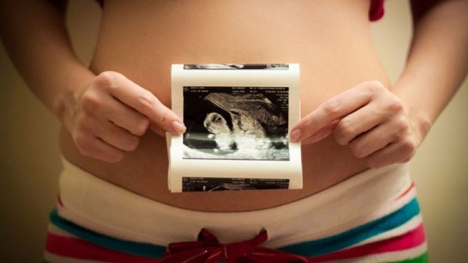 Израелският парламент одобри вчера реформа която цели да се улесни