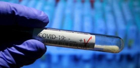 Държавите членки на ЕС трябва да започнат отсега да се подготвят