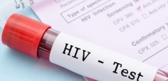 Четвърти пациент в света се излекува напълно от вируса на