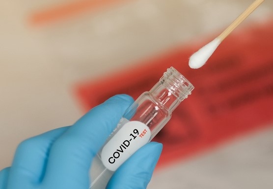 През последното денонощие у нас са регистрирани 1770 нови случая на коронавирус