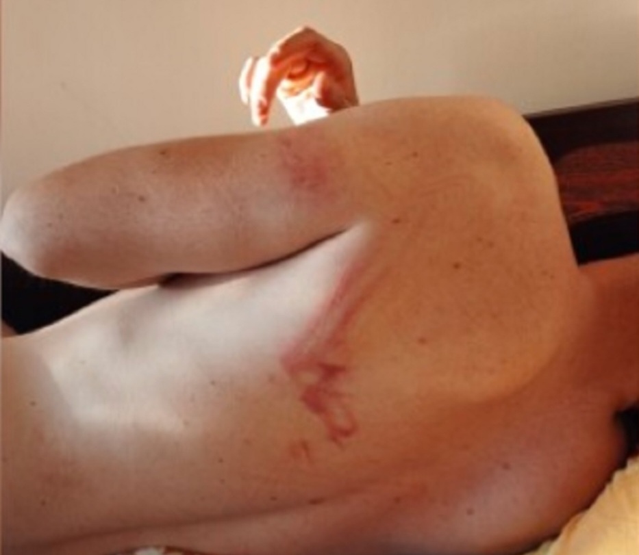 Млад мъж от Козлодуй се оплака от полицейско насилие На