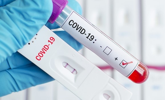 937 са новите случаи на коронавирус у нас за последните