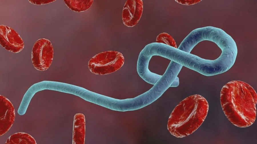 Лекар почина от Ебола в Уганда, расте броят на жертвите на вируса