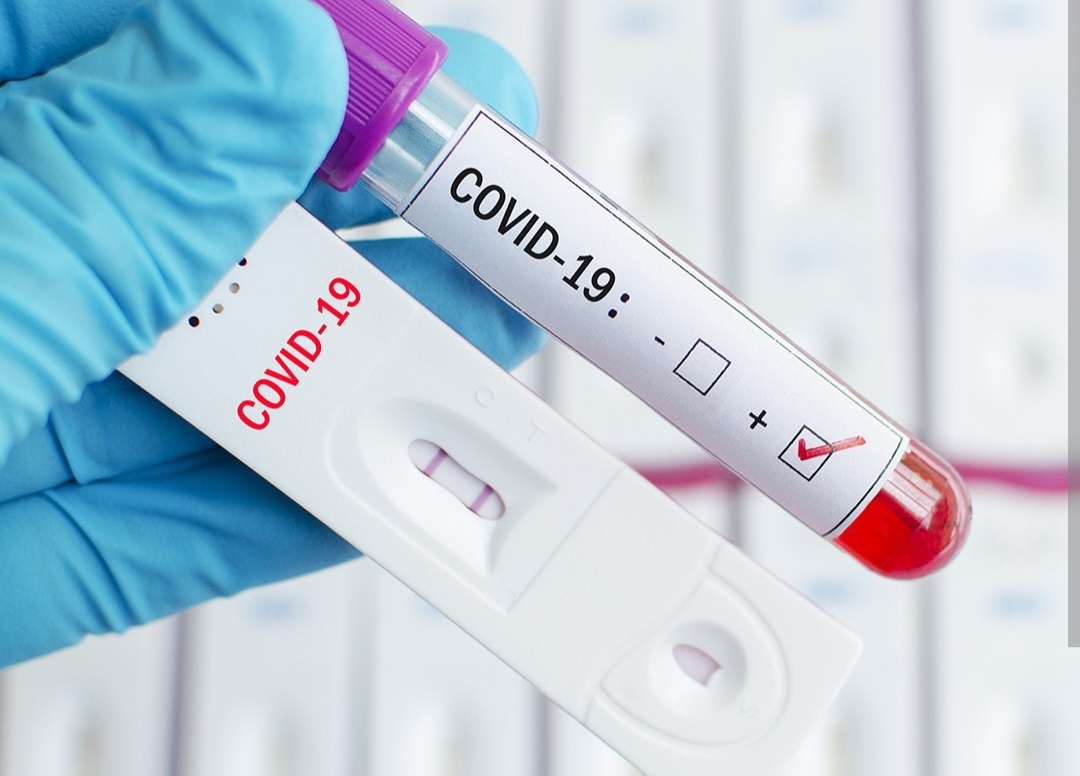 586 са новите случаи на коронавирус в България показват данните