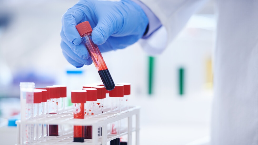 Mинистерството на вътрешните работи обеща кръвните тестове за наркотици да