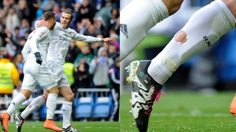 Дупките в чорапите се превърнаха в неочаквана но често срещана