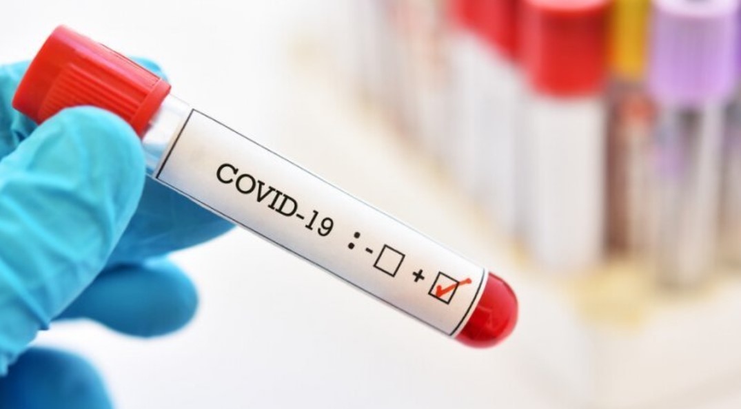 184 са новите случаи на COVID 19 у нас За последните