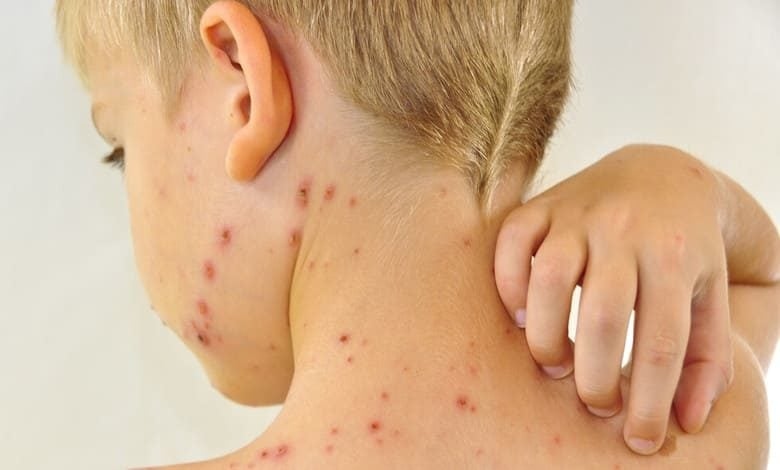 В много от области в страната се увеличават случаите на