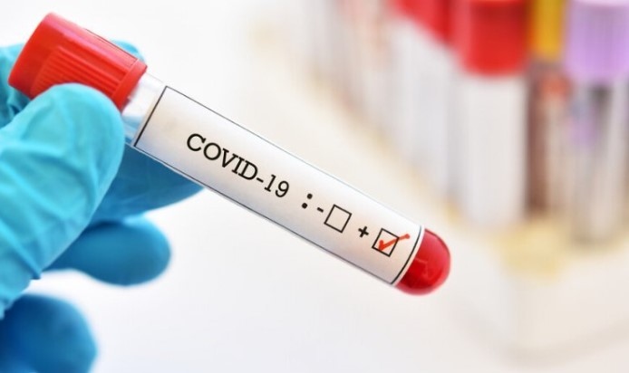 137 са новите случаи на коронавирус у нас за последното