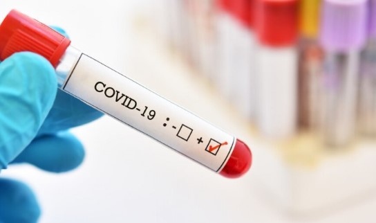 255 са новите случаи на коронавирус у нас показват данните