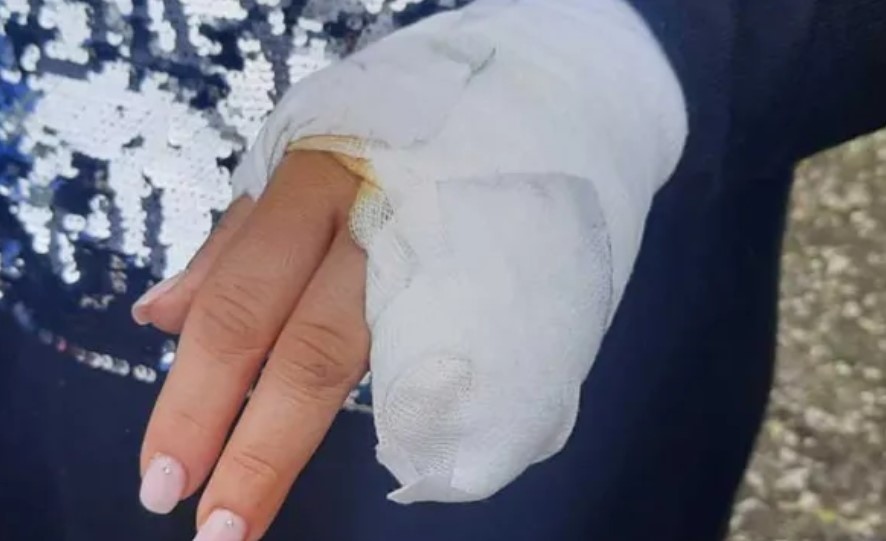 Бременна жена е с тежка травма на ръката след посещение