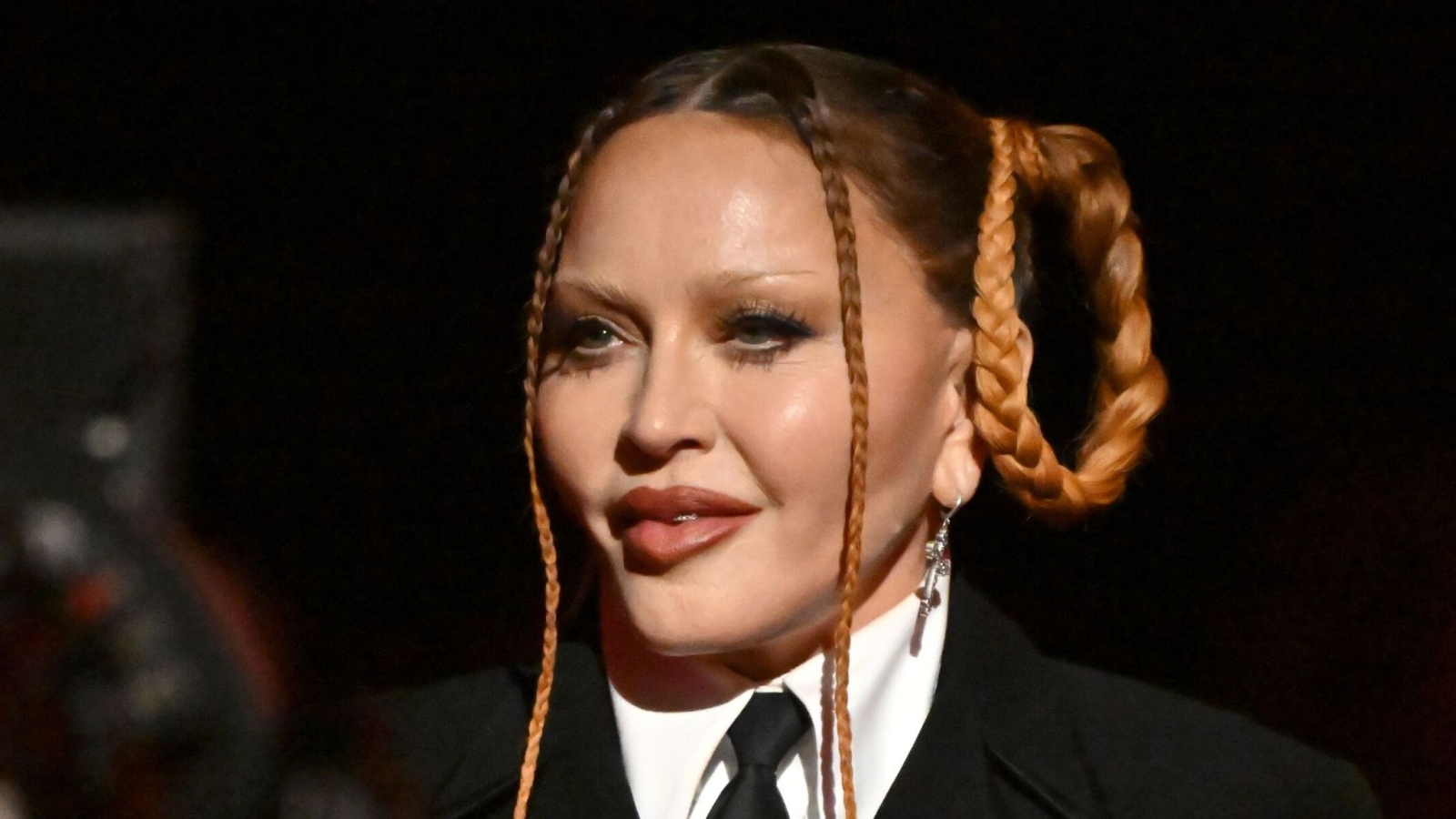 Мадона е приета в болница със сериозна бактериална инфекция съобщава