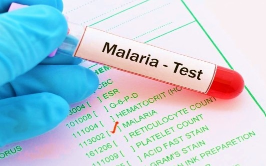 Малария се появи в САЩ за първи път от 20