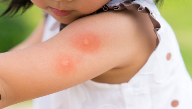 Има възможност от разпространение на малария защото болният човек е