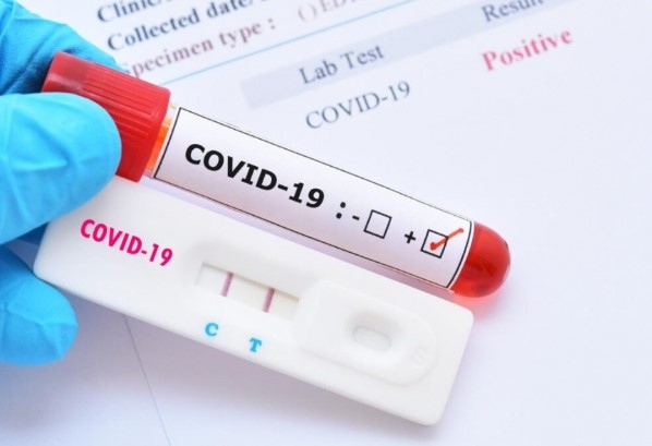 253 нови случая на коронавирус са били регистрирани през последното