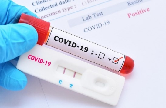 Изискването за поставяне под карантина на болен от COVID-19 и