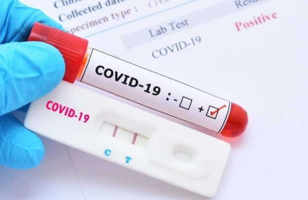 310 са новите случаи на коронавирус у нас. Направени са