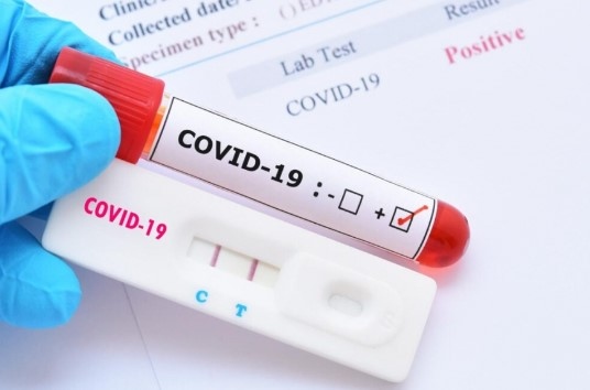 Новите потвърдени случаи на COVID 19 у нас за последното денонощие са