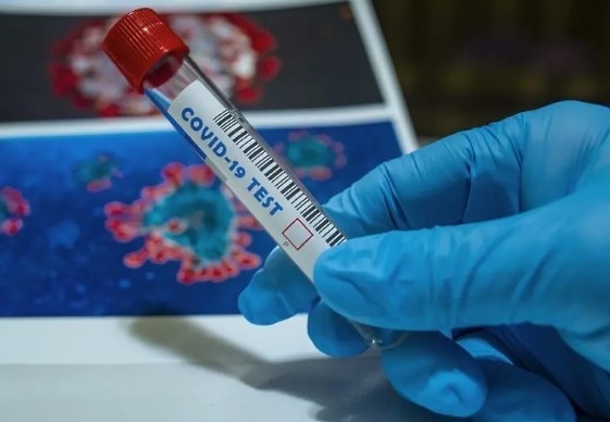 През изминалото денонощие са регистрирани нови 205 заразени с коронавирус