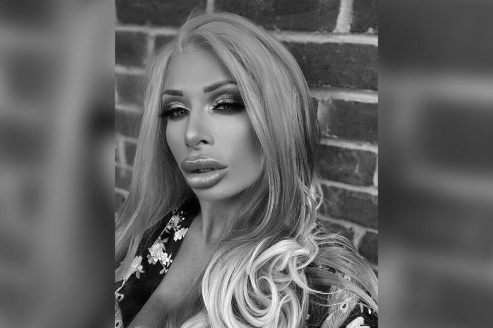 Фалшиви гръдни импланти убиха известна порнозвезда Порнозвездата Софи Андерсън почина на