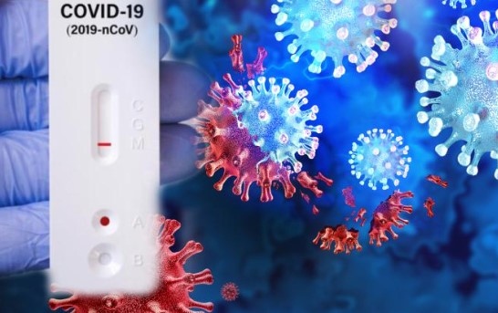 Коронавирусът който причини глобалната пандемия отдавна не се приема като