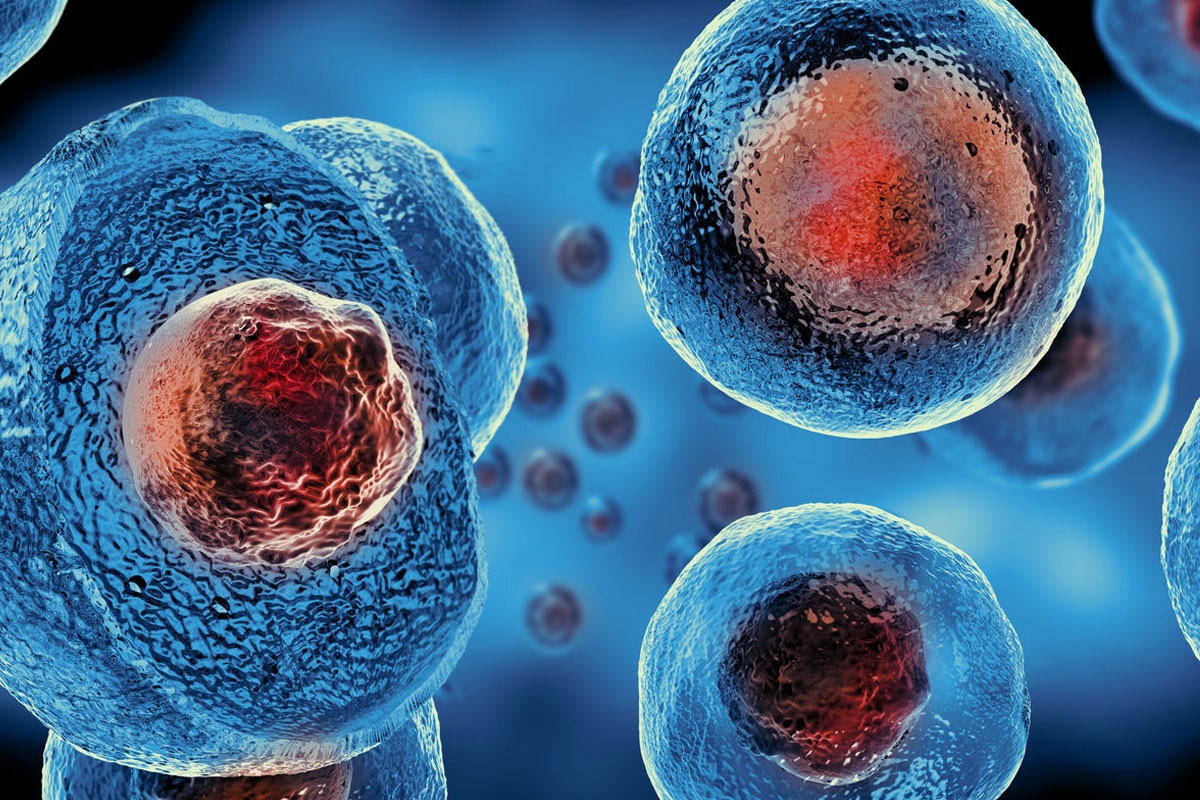 Случаите на онкологични заболявания при хора под 50 г са