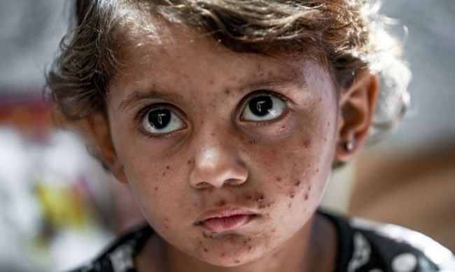 Постоянен поток от нещастни деца и разтревожени родители се вливат