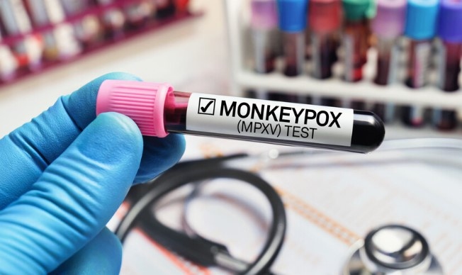 Здравната агенция на Европейския съюз призова държавите членки да се