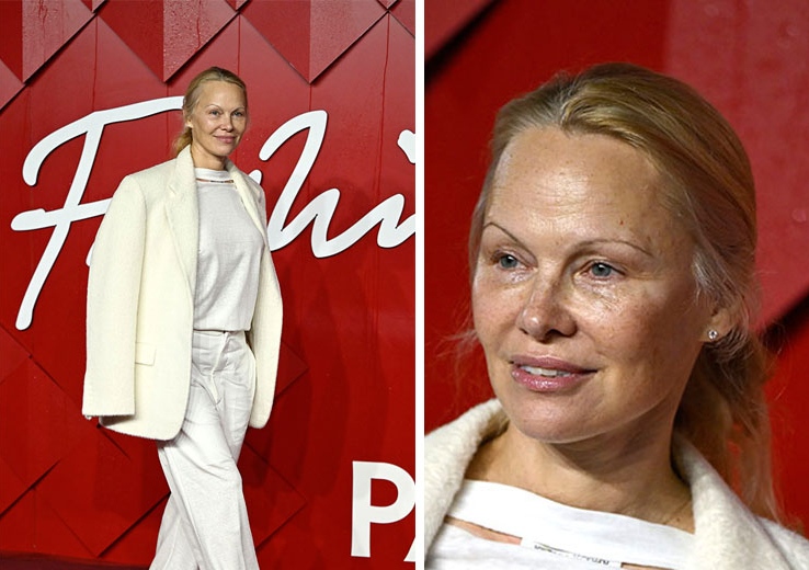 Памела Андерсън със сигурност знае какво е да претърпиш върхове