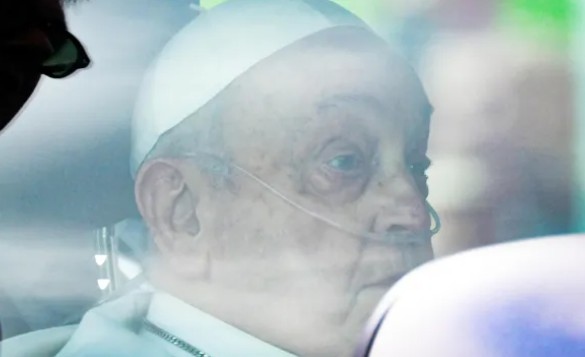 Рентгенова снимка на гръдния кош е потвърдила леко подобрение в