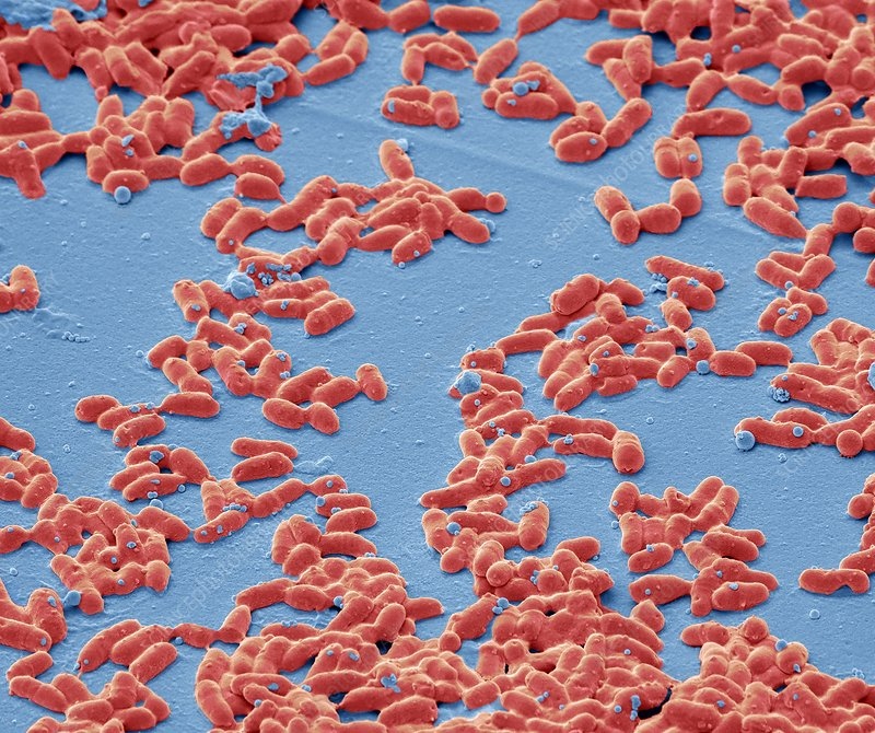 На фона на най голямата епидемия от дифтерия в Западна Европа