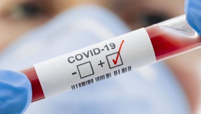 С настъпването на есента респираторните заболявания отново набират скорост Лекарите