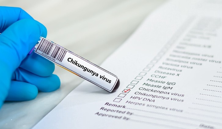 Първи случай на вируса на треската чикунгуня е потвърден в Румъния съобщи